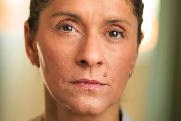 TDRP Role Play Actor and Assessor – Chandrika